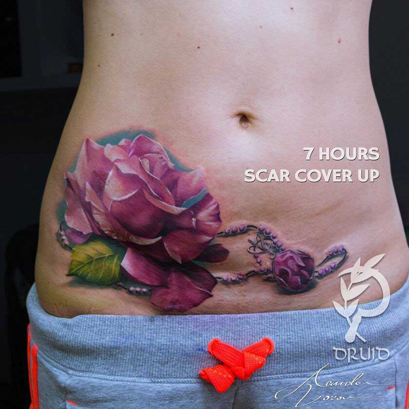 Scar Cover Up Tattoo on Belly | Best Tattoo Ideas Gallery